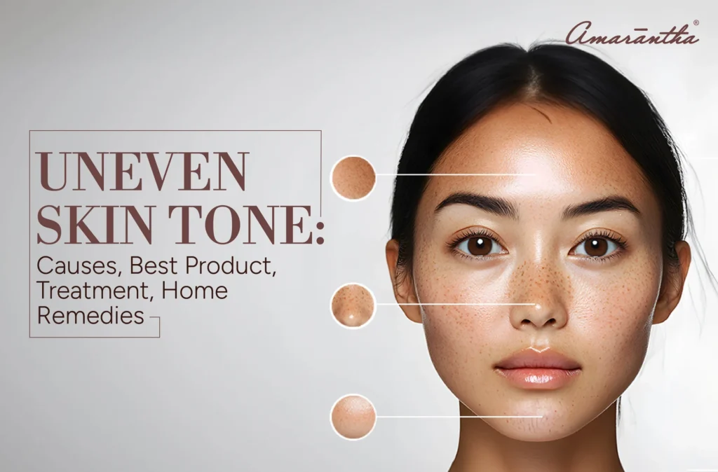 Understanding and Treating Uneven Skin Tone: A Comprehensive Guide